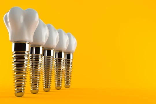 Clínica de implantes dentários