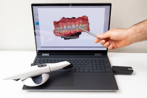 Escaneamento intraoral