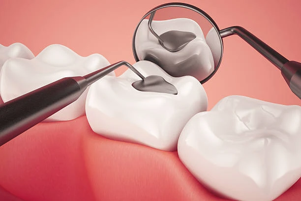 Restauração de dente